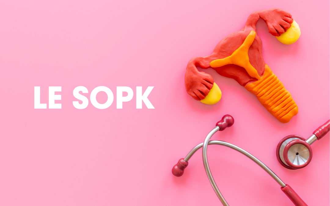 SOPK ou Syndrome des Ovaires Polykystiques : qu’est-ce que c’est ?